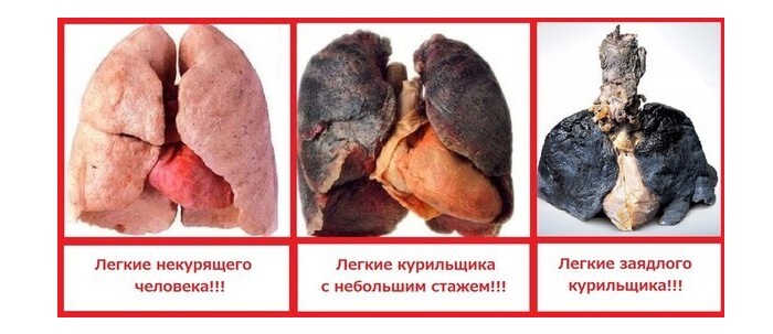 Влияние курения на легкие