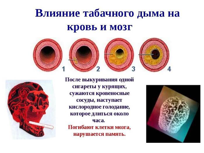 Влияние курения на сосуды
